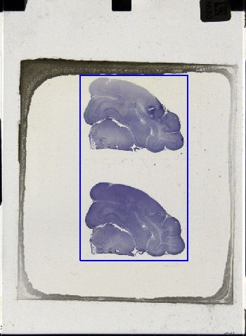 Media type: image; Special Collections 3043   shows specimen_part histological serial section;
